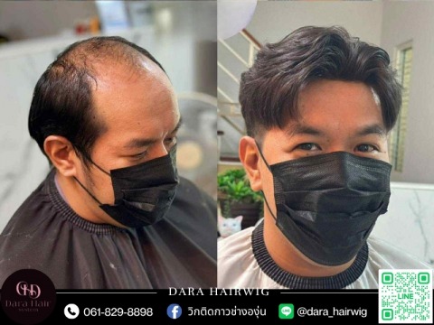 วิกผมติดกาวคุณภาพสูง